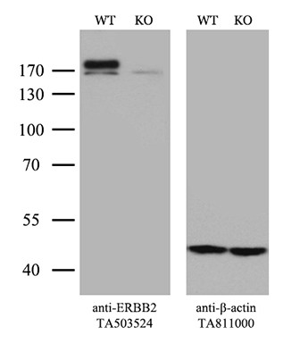ERBB2 Antibody