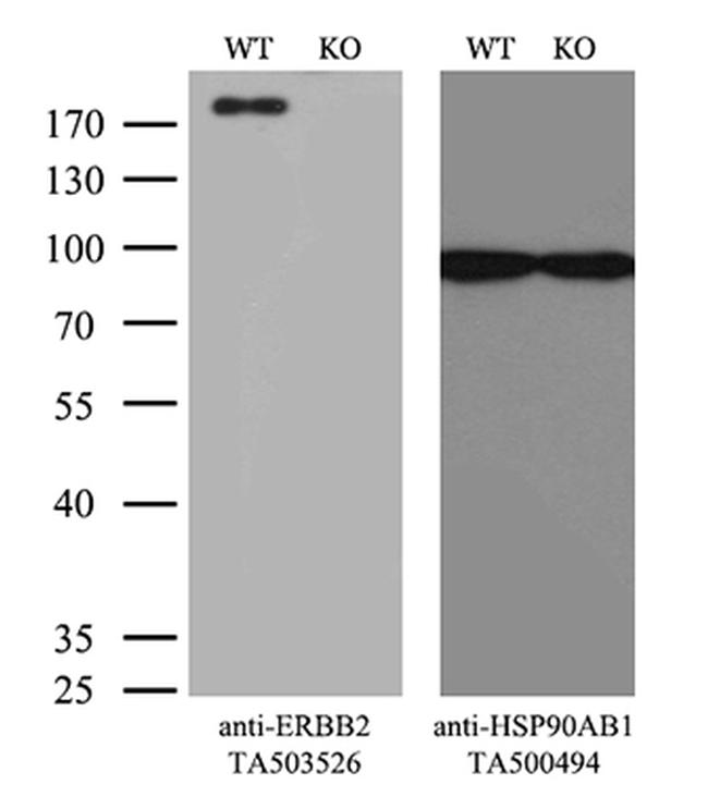 ERBB2 Antibody in Western Blot (WB)