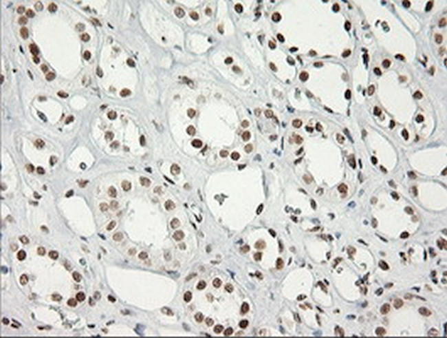 ERCC1 Antibody in Immunohistochemistry (Paraffin) (IHC (P))
