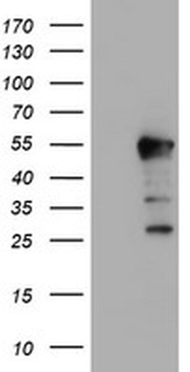 ERI1 Antibody in Western Blot (WB)