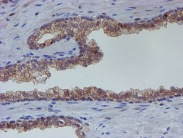 ESR1 Antibody in Immunohistochemistry (Paraffin) (IHC (P))