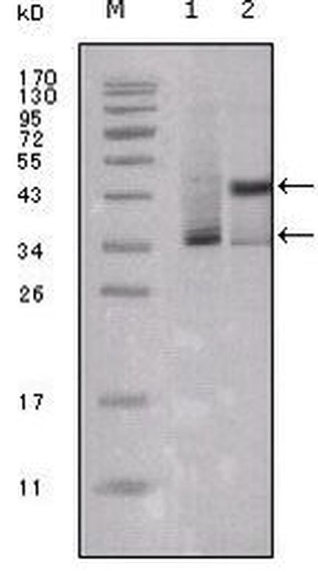 Estrogen Receptor alpha Antibody in Western Blot (WB)