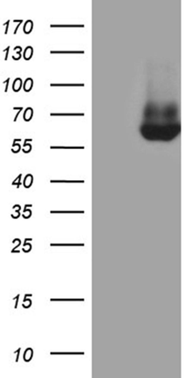 ESR2 Antibody in Western Blot (WB)