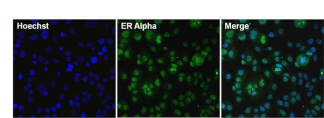 Estrogen Receptor alpha Antibody in Immunocytochemistry (ICC/IF)