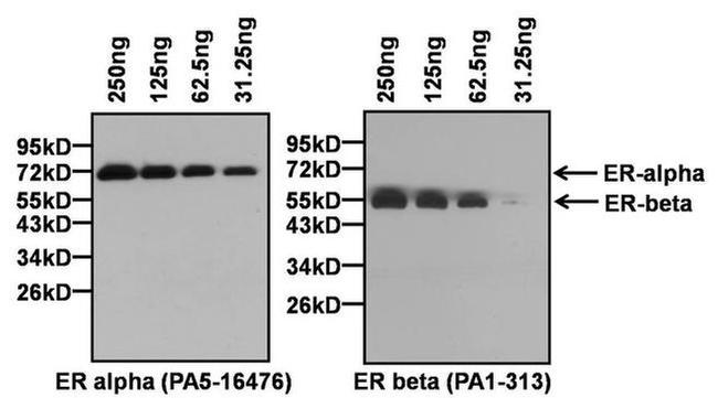 Estrogen Receptor alpha Antibody in Western Blot (WB)