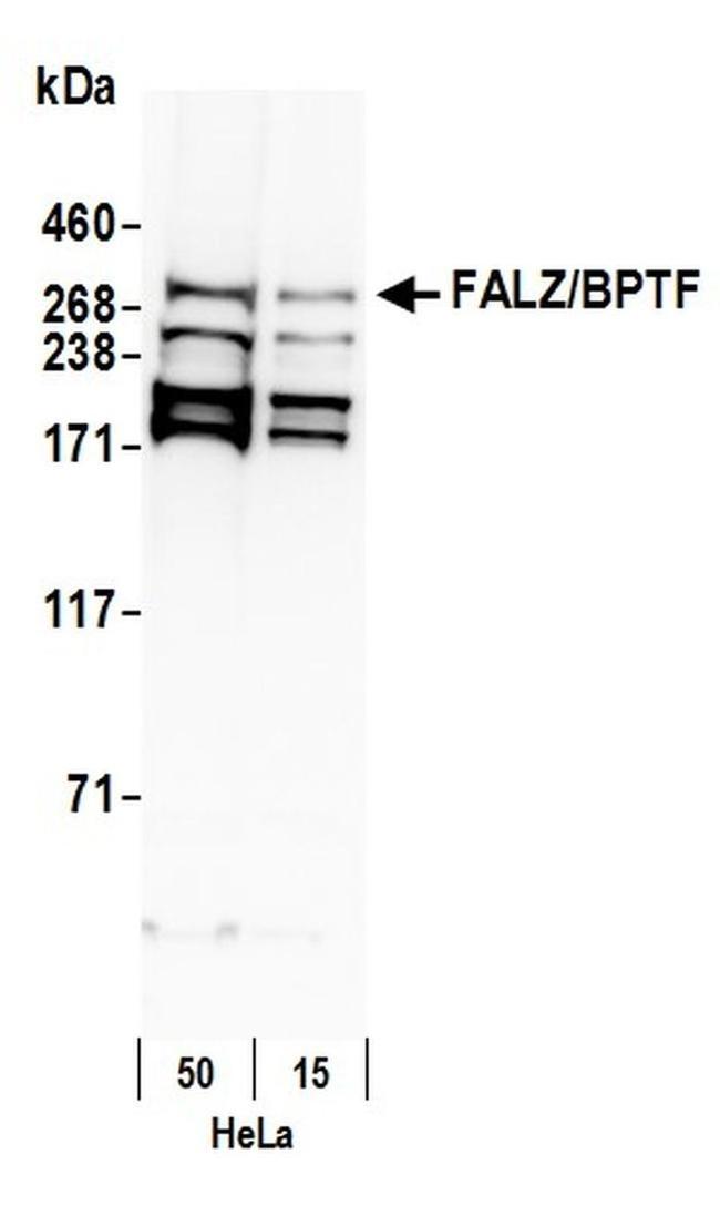 FALZ/BPTF Antibody in Western Blot (WB)