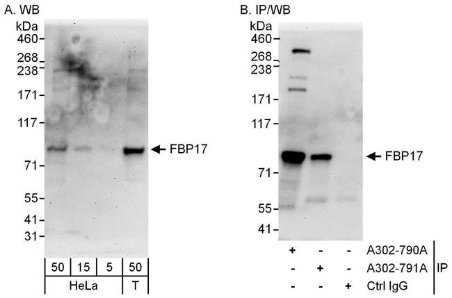FBP17 Antibody in Western Blot (WB)