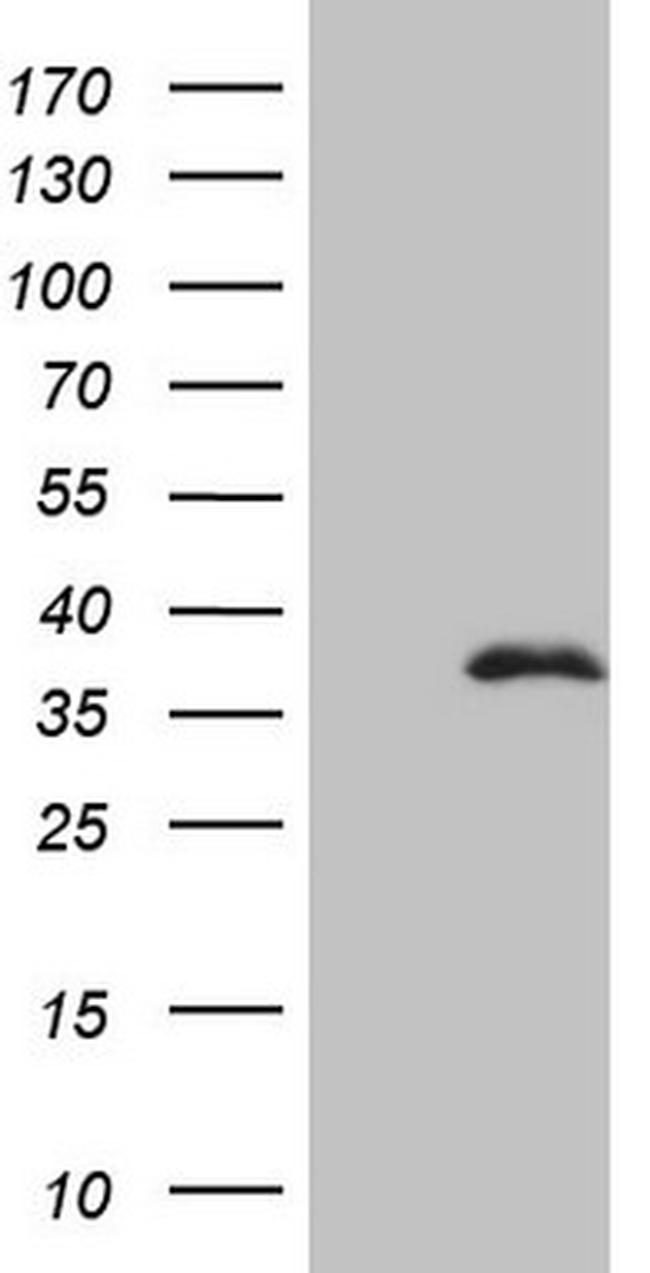 FBXO8 Antibody in Western Blot (WB)
