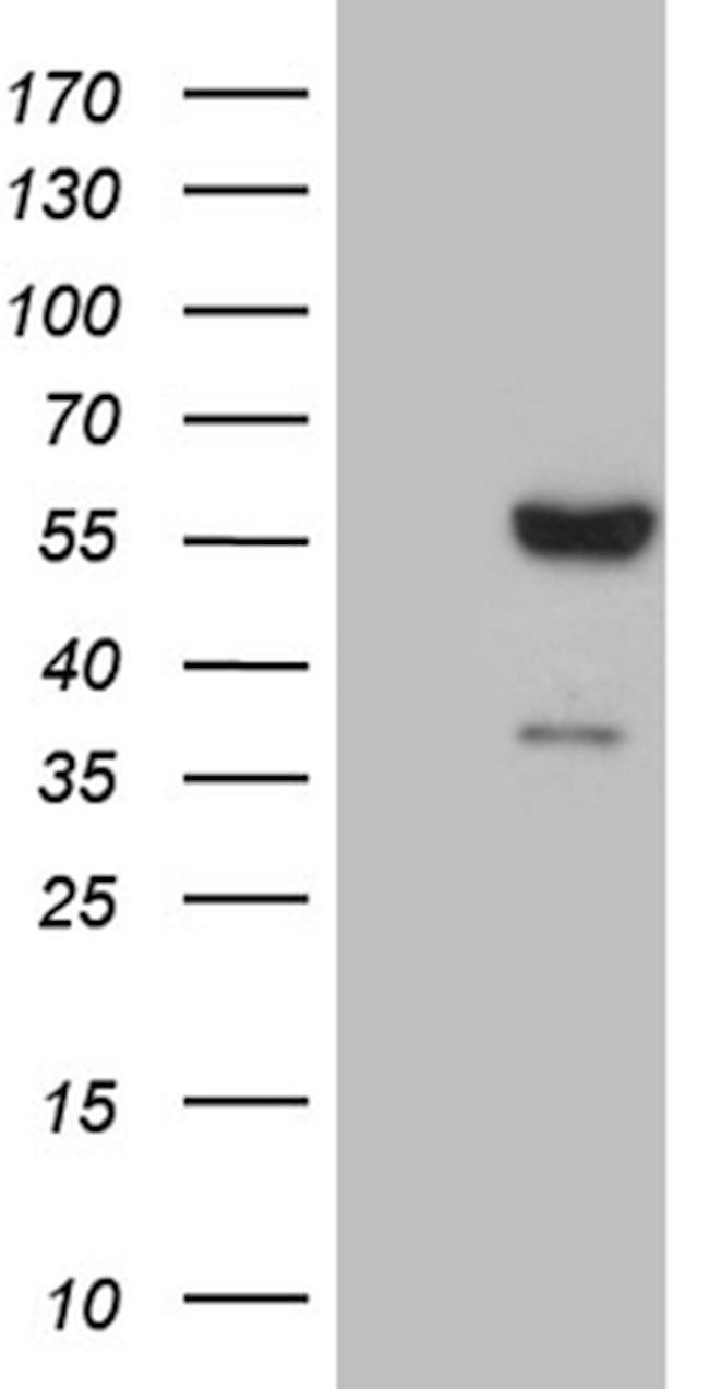 FCRLB Antibody in Western Blot (WB)