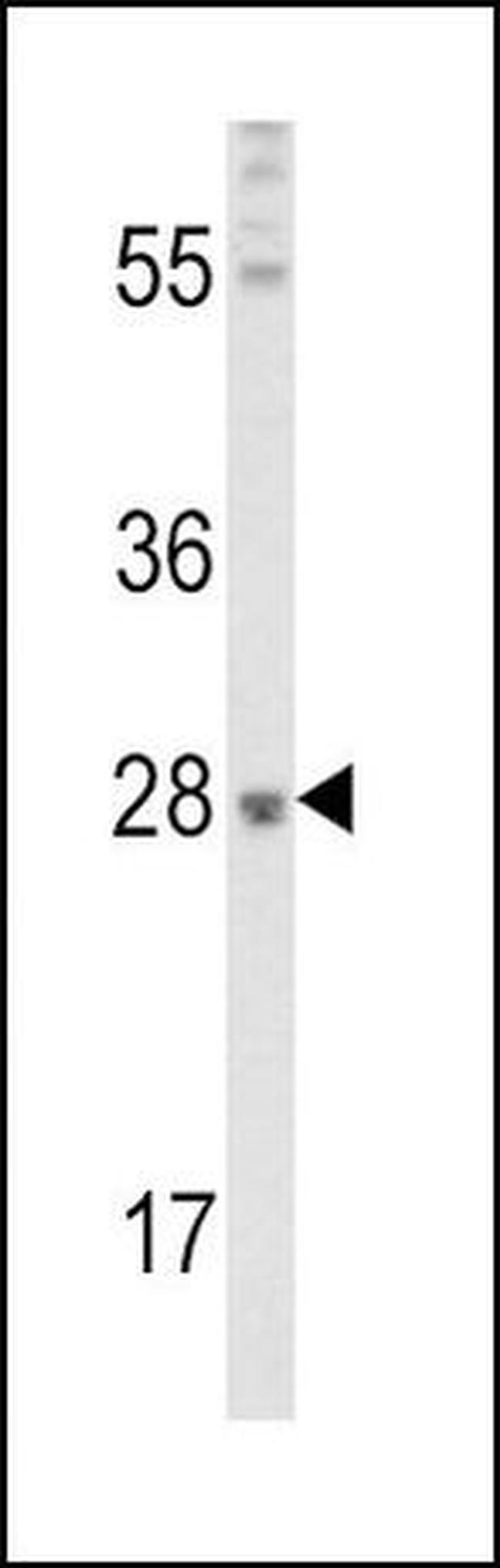 FGF10 Antibody in Western Blot (WB)