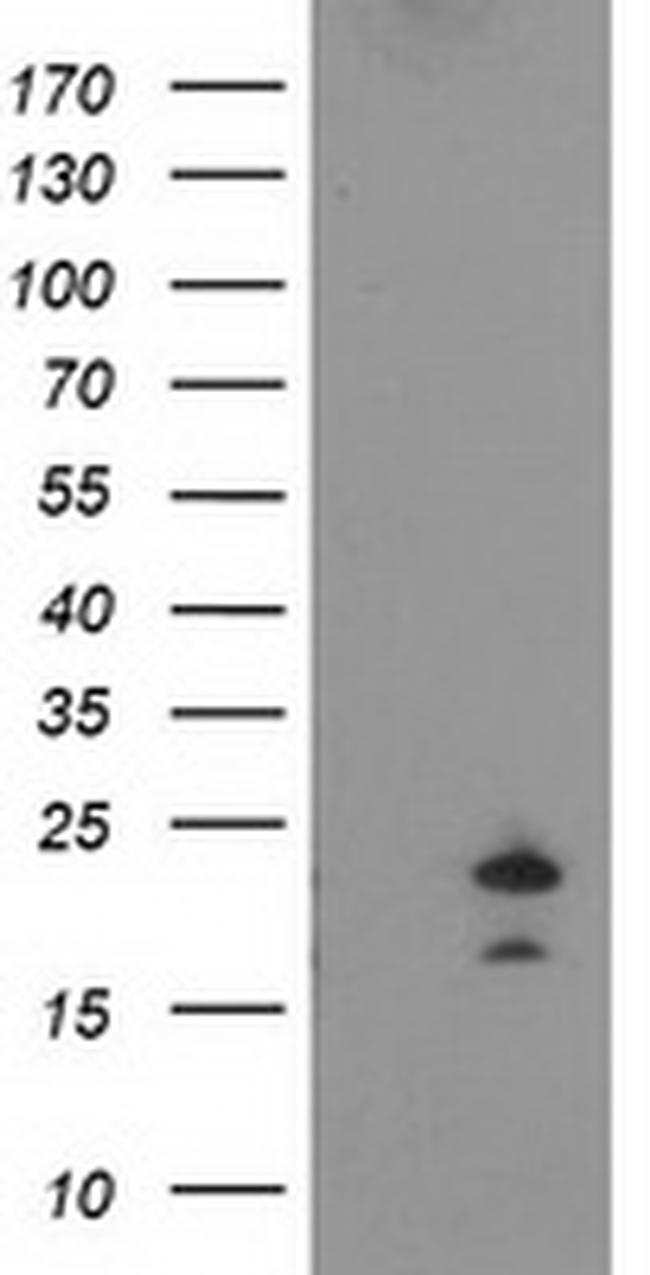 FGF21 Antibody in Western Blot (WB)