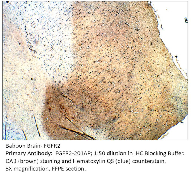 FGFR2 Antibody in Immunohistochemistry (IHC)