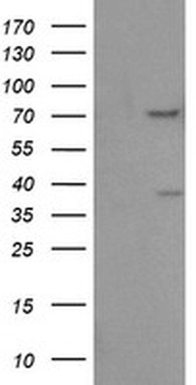 FMR1 Antibody in Western Blot (WB)
