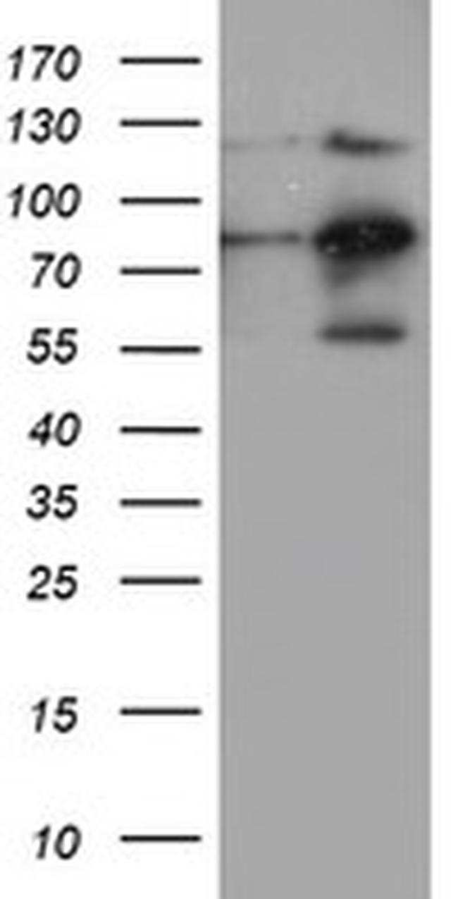 FOLH1 Antibody in Western Blot (WB)