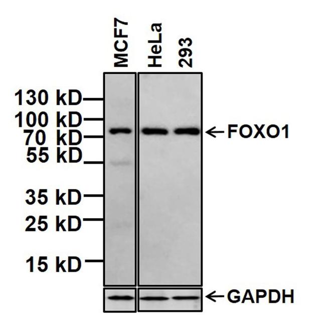 FOXO1 Antibody in Western Blot (WB)