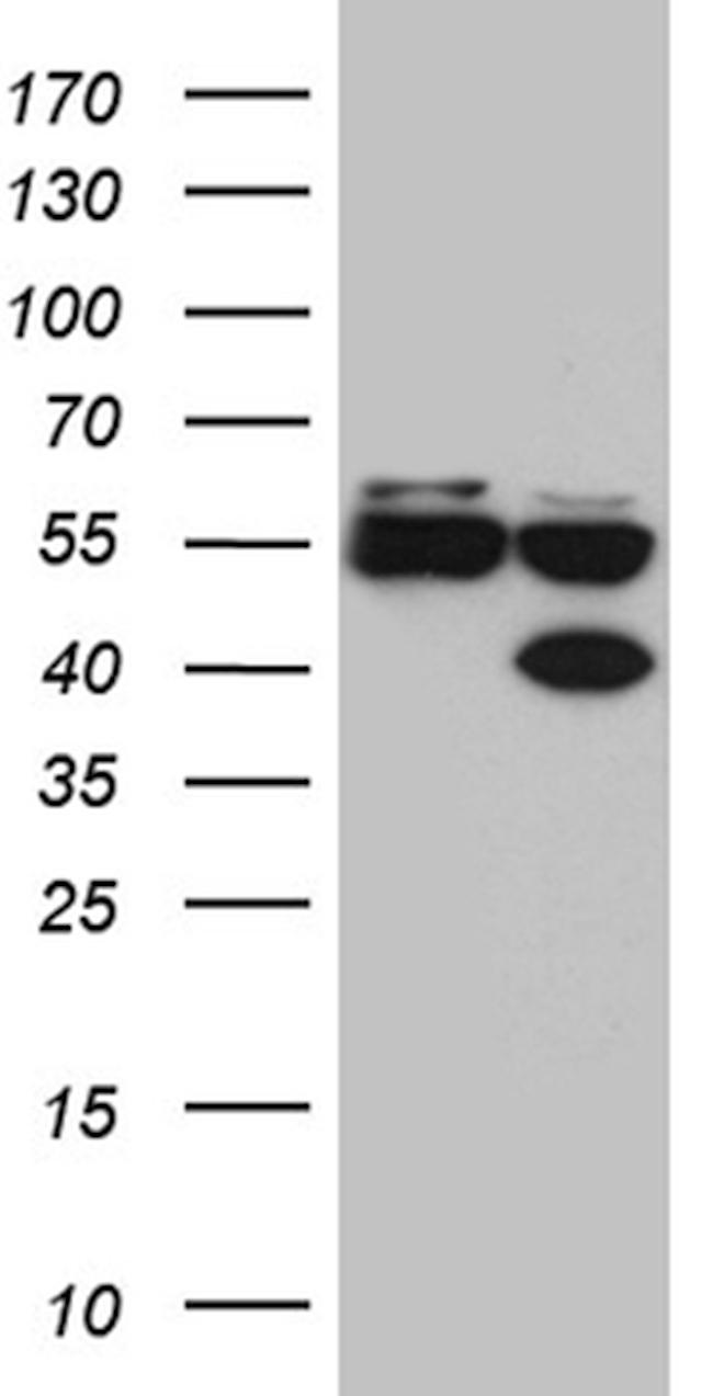 FOXR1 Antibody in Western Blot (WB)