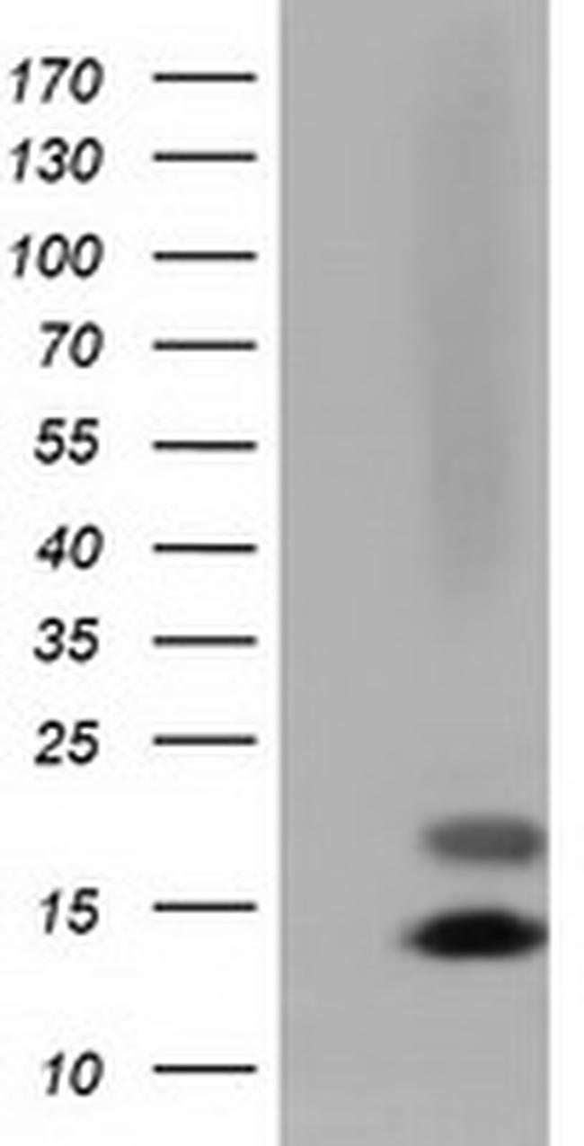 FSHB Antibody in Western Blot (WB)