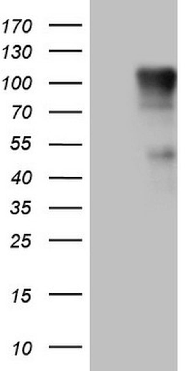 FSIP1 Antibody in Western Blot (WB)