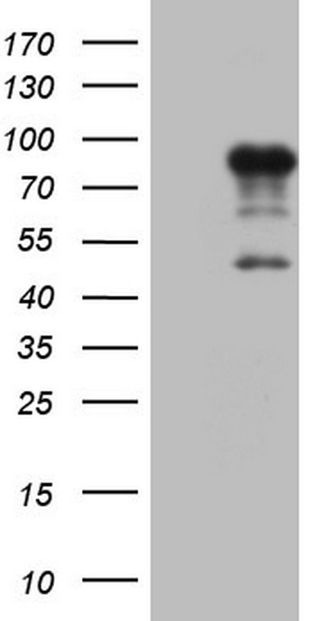 FSIP1 Antibody in Western Blot (WB)