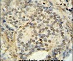 FUS Antibody in Immunohistochemistry (Paraffin) (IHC (P))