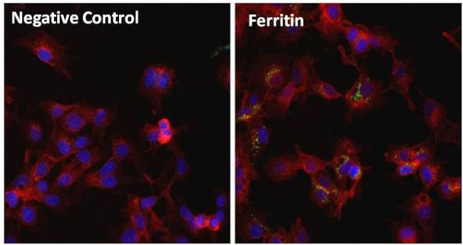 Ferritin Antibody in Immunocytochemistry (ICC/IF)