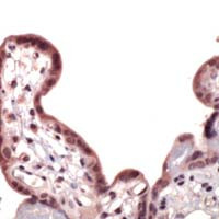 Nrf2 Antibody in Immunohistochemistry (Paraffin) (IHC (P))
