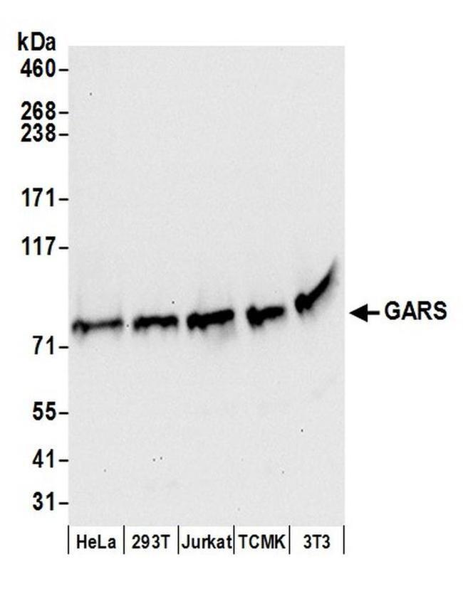 GARS Antibody in Western Blot (WB)
