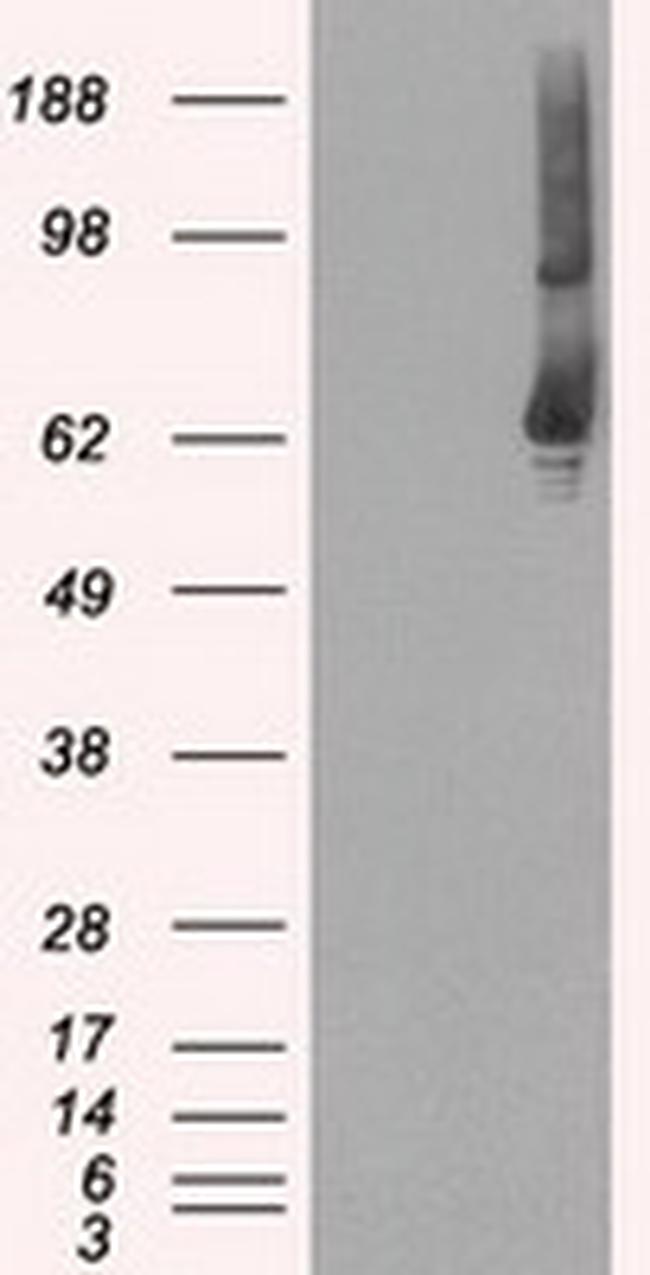 GBP2 Antibody in Western Blot (WB)