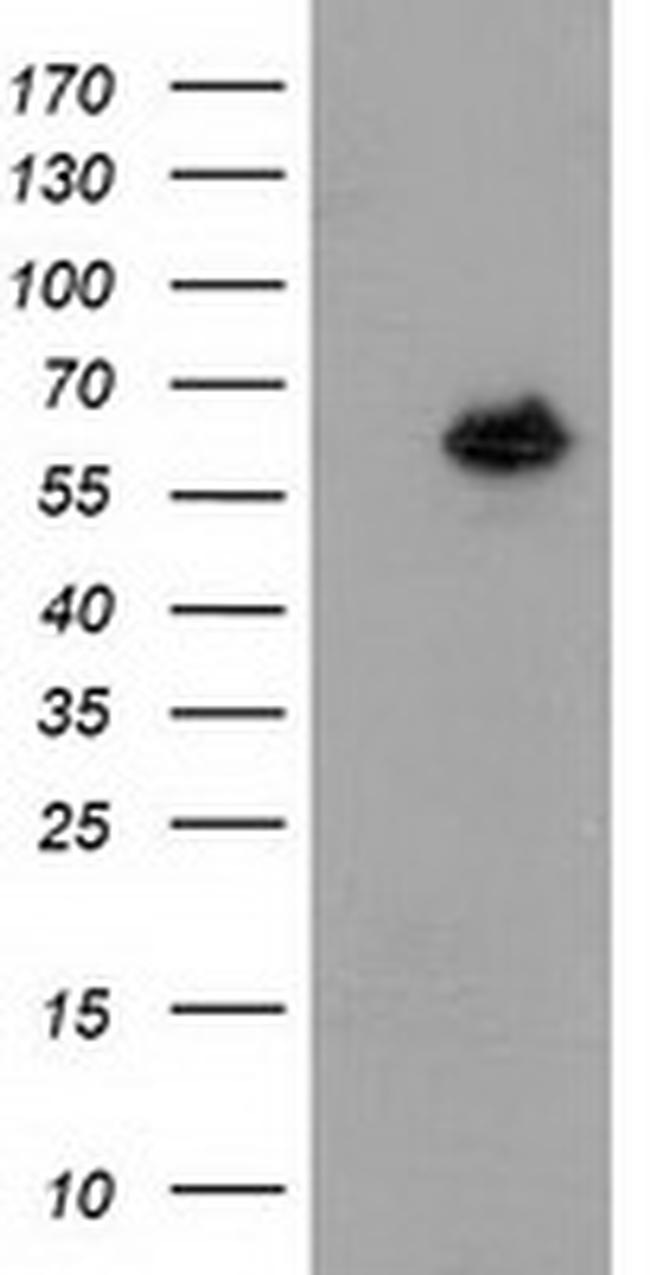 GBP5 Antibody in Western Blot (WB)