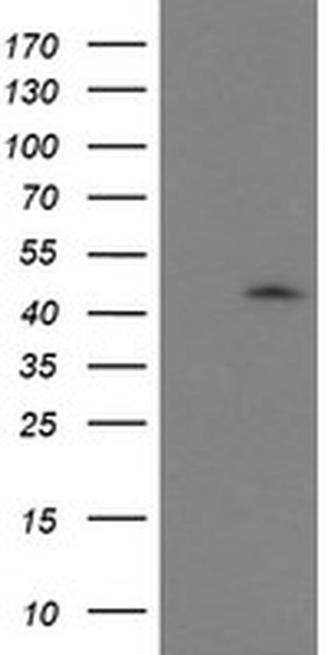 GDAP1L1 Antibody in Western Blot (WB)