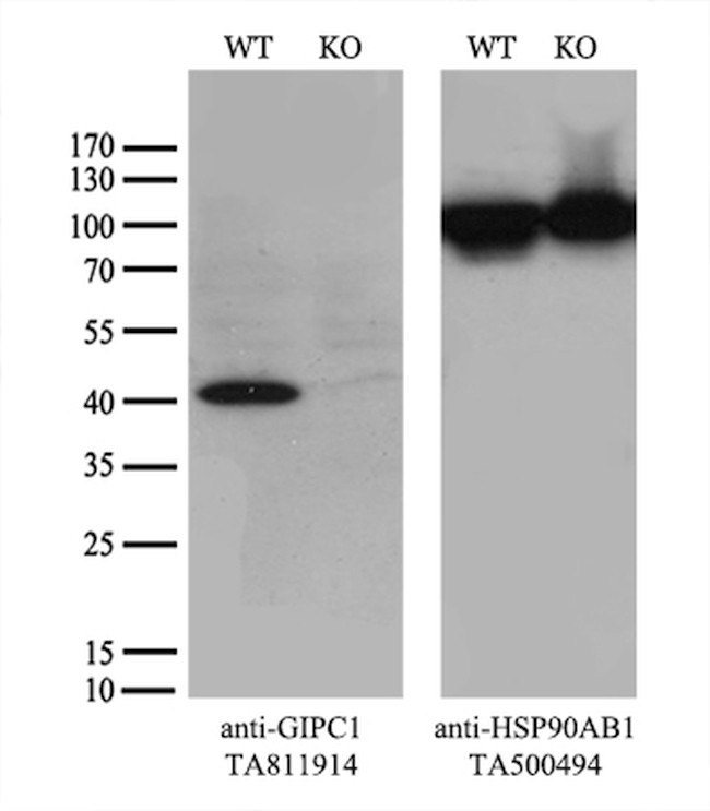 GIPC1 Antibody