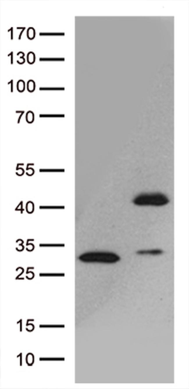 GIPC1 Antibody in Western Blot (WB)