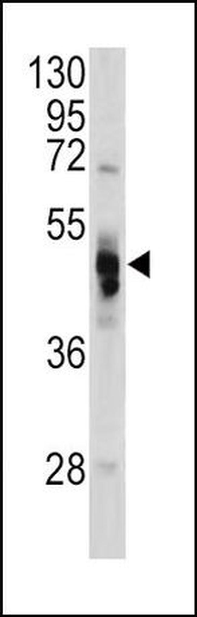 alpha Galactosidase Antibody in Western Blot (WB)