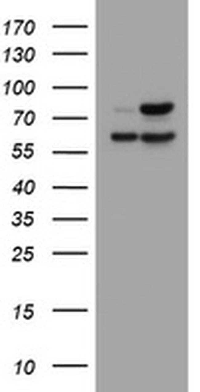GLB1 Antibody in Western Blot (WB)