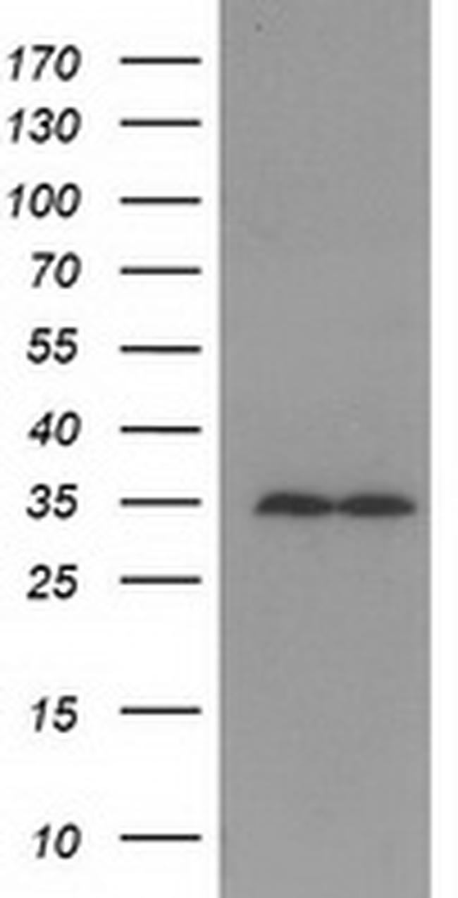 GNB2L1 Antibody in Western Blot (WB)