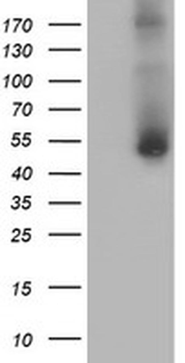 GOLM1 Antibody in Western Blot (WB)