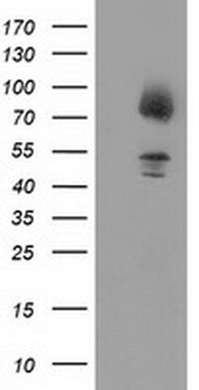 GPHN Antibody in Western Blot (WB)