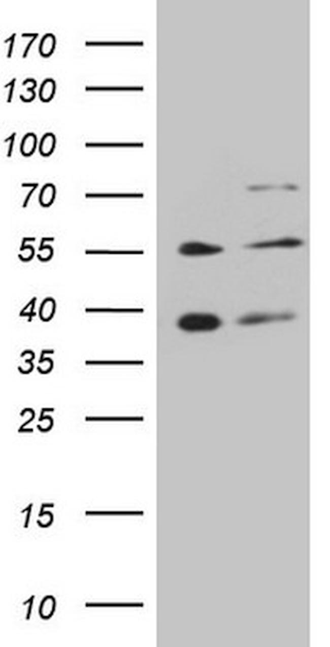GRK4 Antibody in Western Blot (WB)