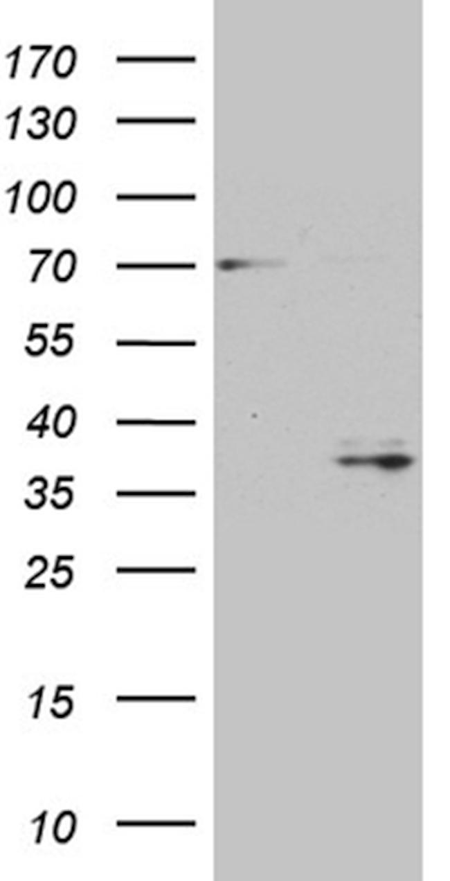GSG1 Antibody in Western Blot (WB)