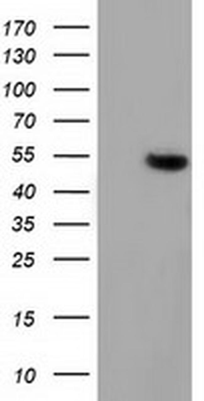 GSS Antibody in Western Blot (WB)