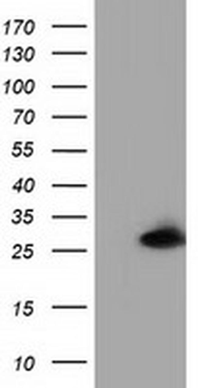 GSTT2 Antibody in Western Blot (WB)