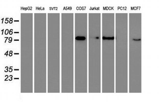 GTF2F1 Antibody in Western Blot (WB)