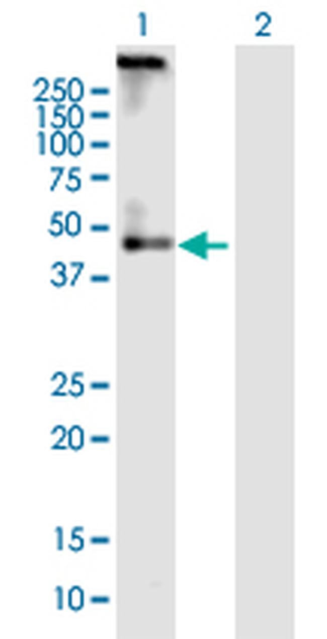 ADRB2 Antibody in Western Blot (WB)