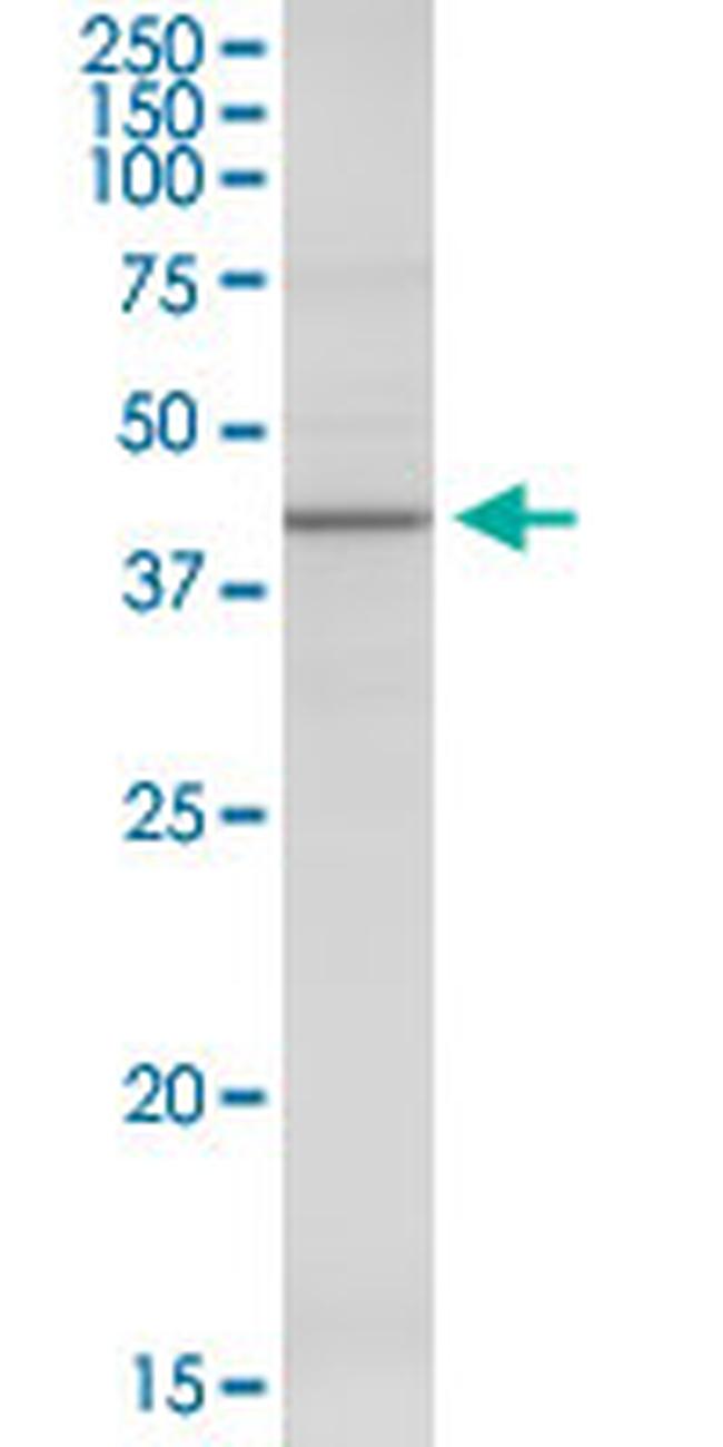 AMBP Antibody in Western Blot (WB)
