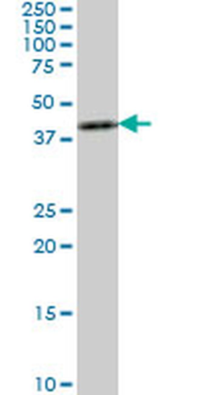 ASCL1 Antibody in Western Blot (WB)