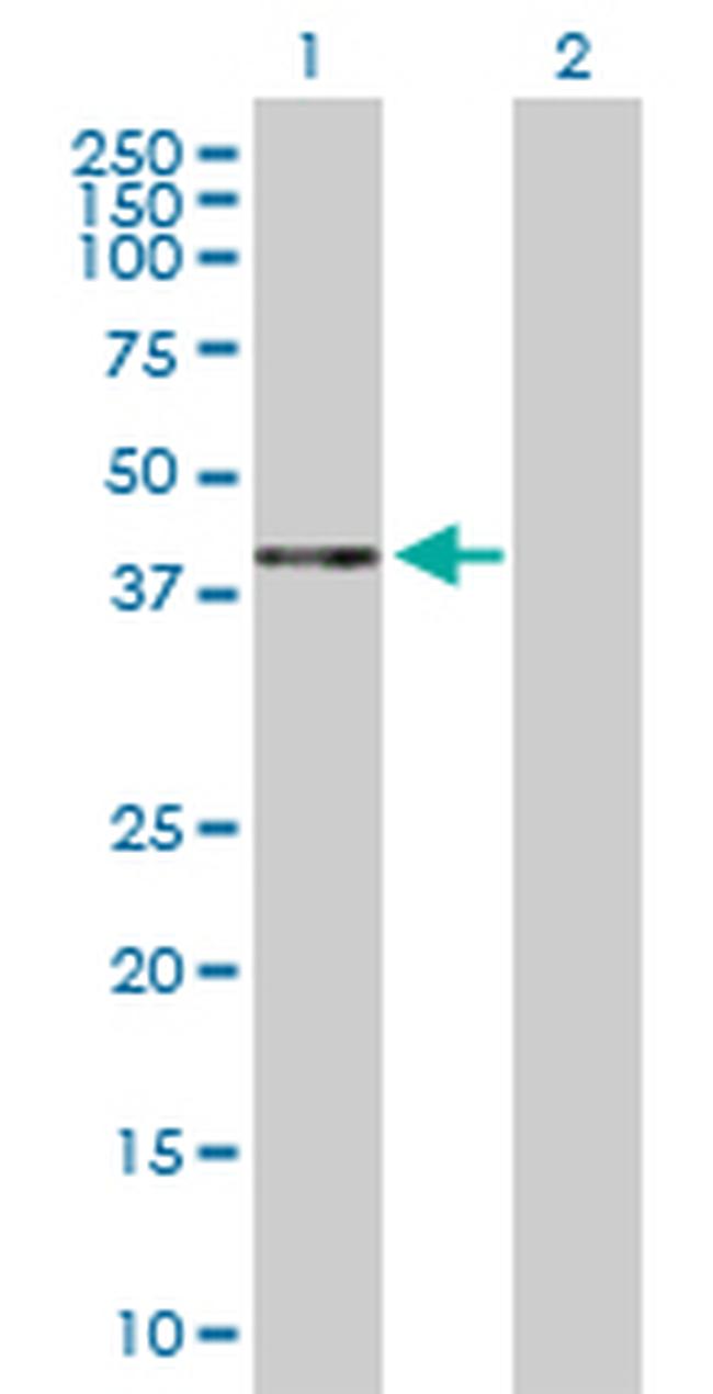 HAPLN1 Antibody in Western Blot (WB)