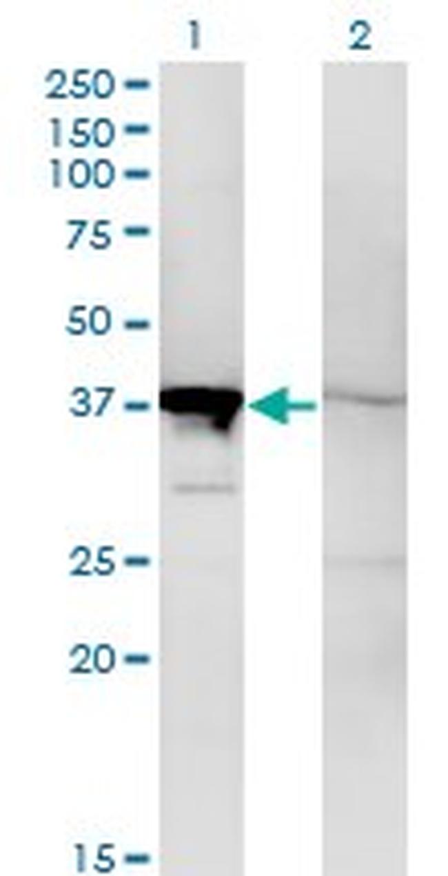 MAPK14 Antibody in Western Blot (WB)