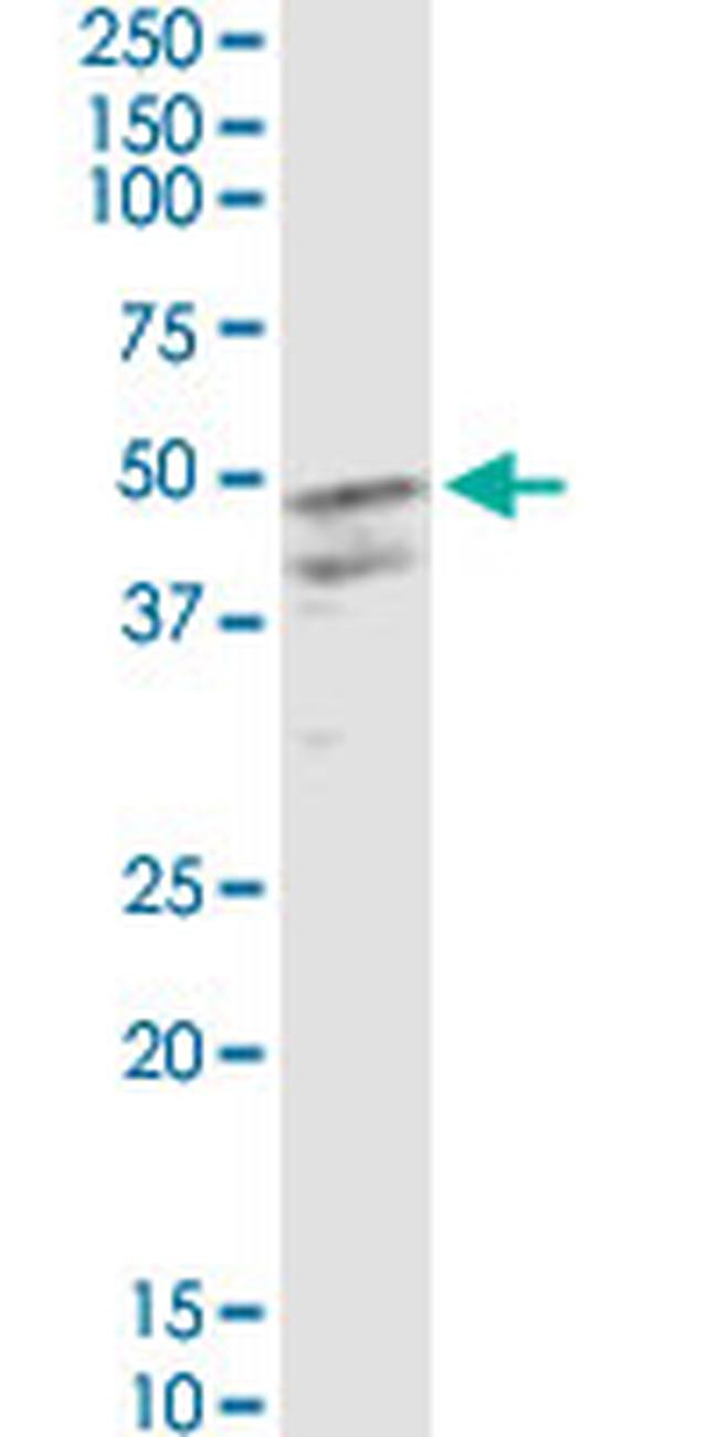 CSF2 Antibody in Western Blot (WB)