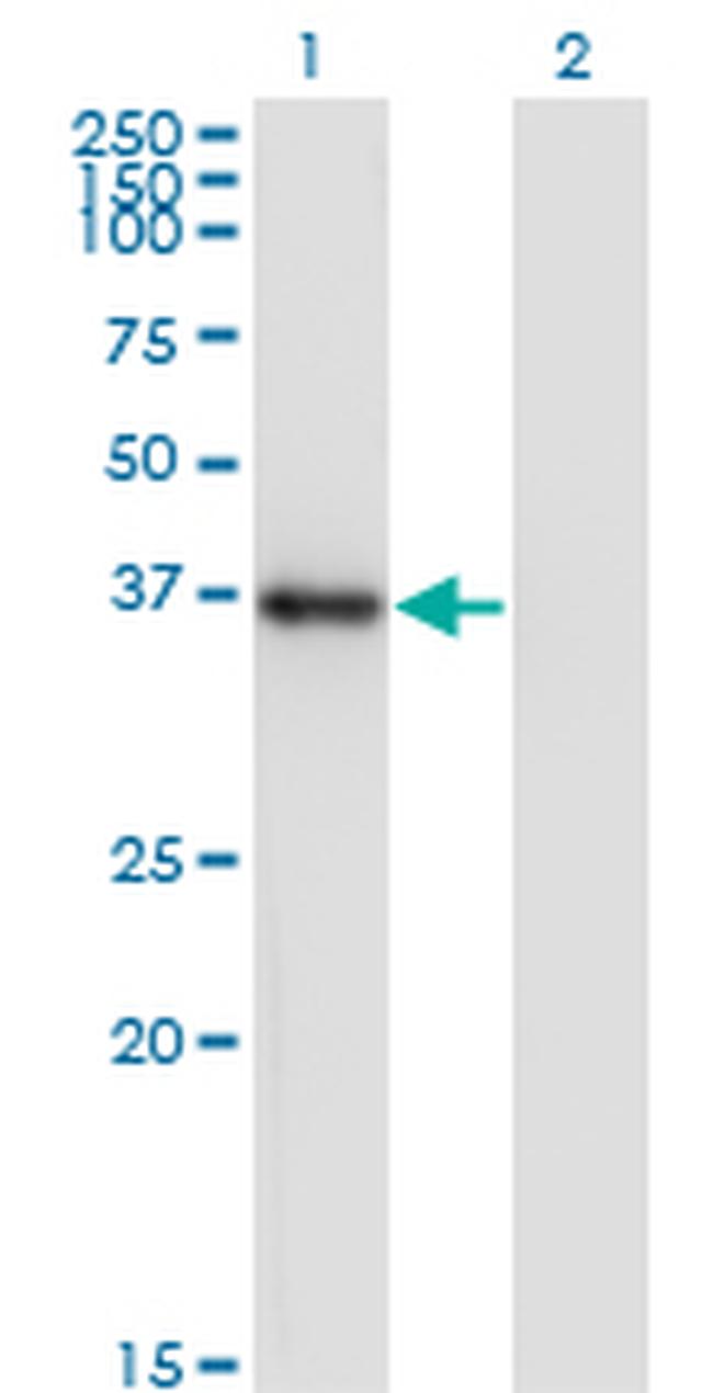 NKX2-5 Antibody in Western Blot (WB)