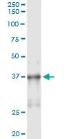 NKX2-5 Antibody in Immunoprecipitation (IP)